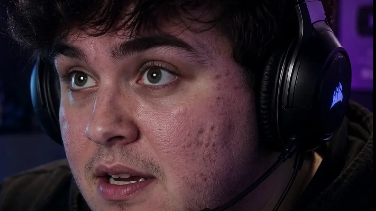 Streamer wearing a gaming headset before skin smoothing, with visible texture and blemishes on the cheek