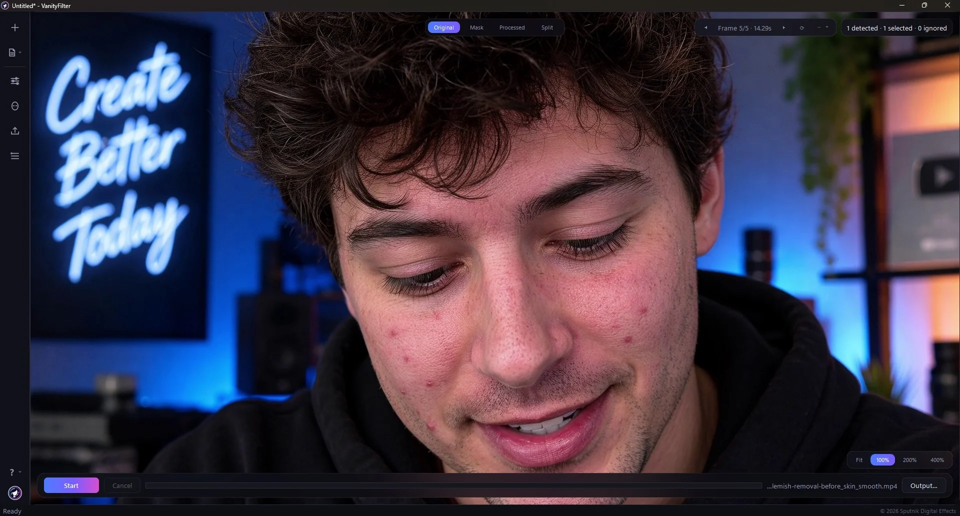 VanityFilter 3.1.5 on the Original tab, showing blemishes and uneven texture across the cheek and chin.